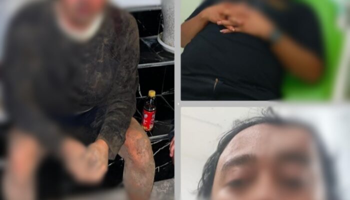 Laporan Dugaan Pengeroyokan Anggota BRN di Pasuruan Belum Tetapkan Tersangka